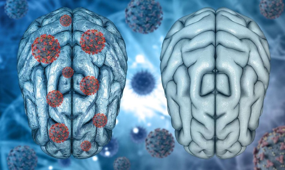 الجسيمات البلاستيكية الدقيقة