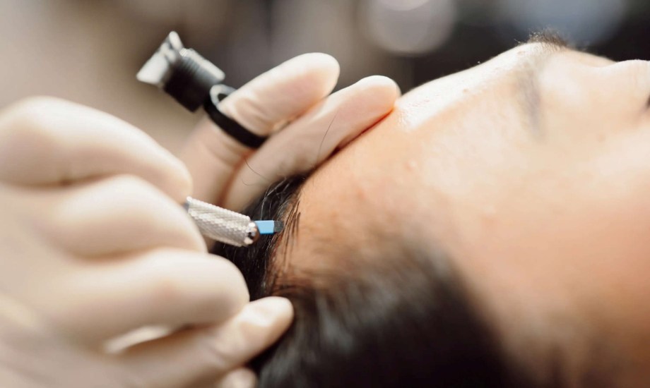 الآثار الجانبية لـ Microblading hairline