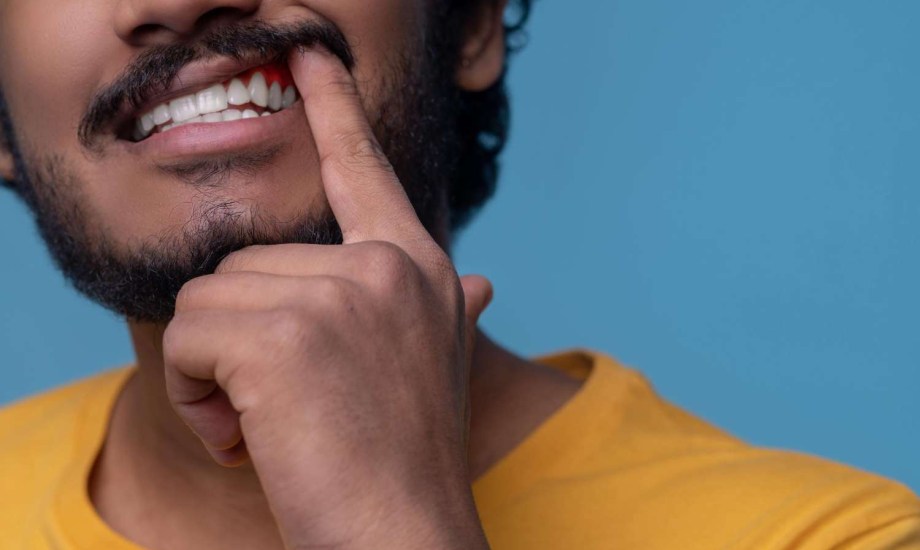 علاقة صحة اللثة بتدهور الذاكرة 