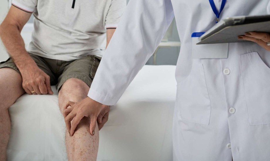 مرضى التهاب المفاصل الصدفي