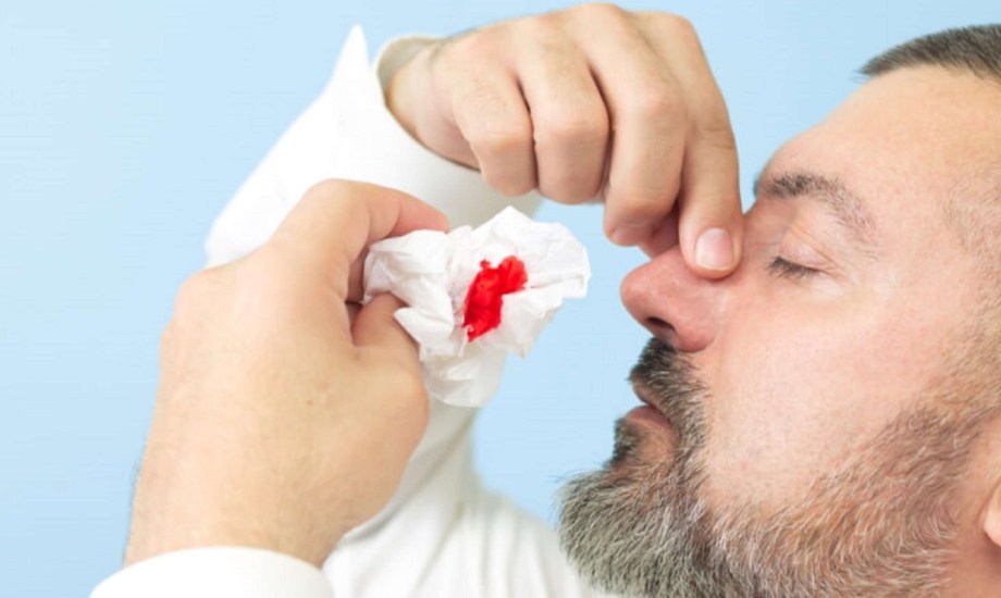 كيفية العناية بالأنف بعد النزيف