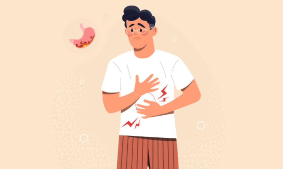 أدوية لعلاج الارتجاع