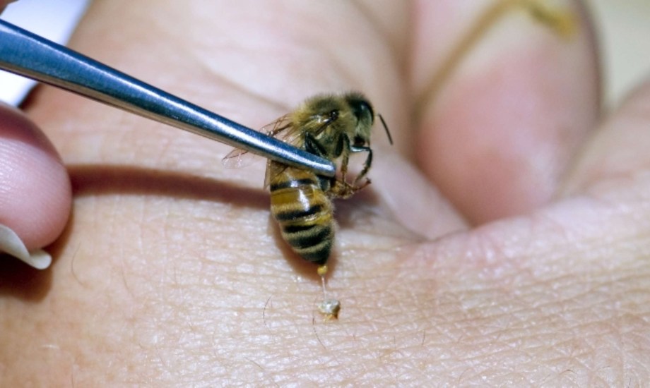 استخدامات سم النحل كعلاج مناعي