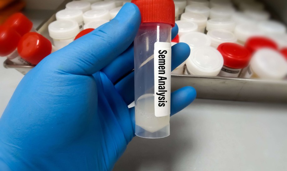 3 إرشادات ضرورية قبل إجراء تحليل السائل المنوي