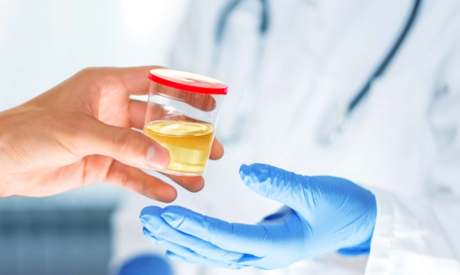 اختبار MPS2 للكشف عن سرطان البروستاتا الأكثر عدوانية