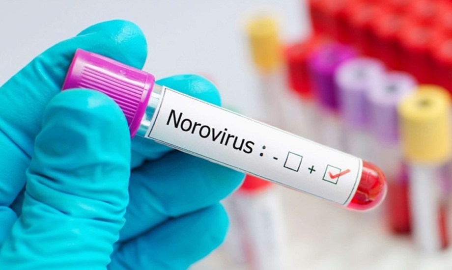  أهمية لقاح نوروفيروس