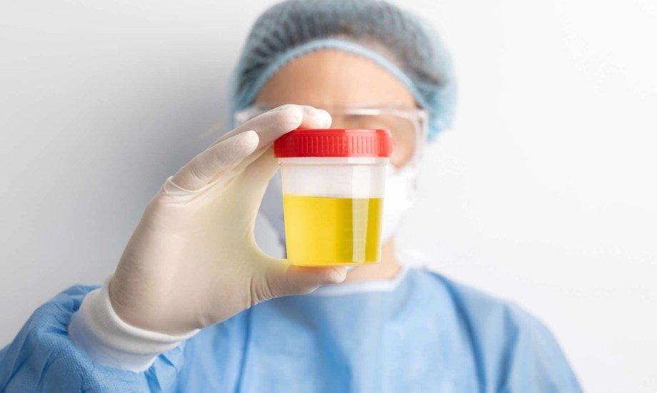 أسباب وعلاج البول الرغوي