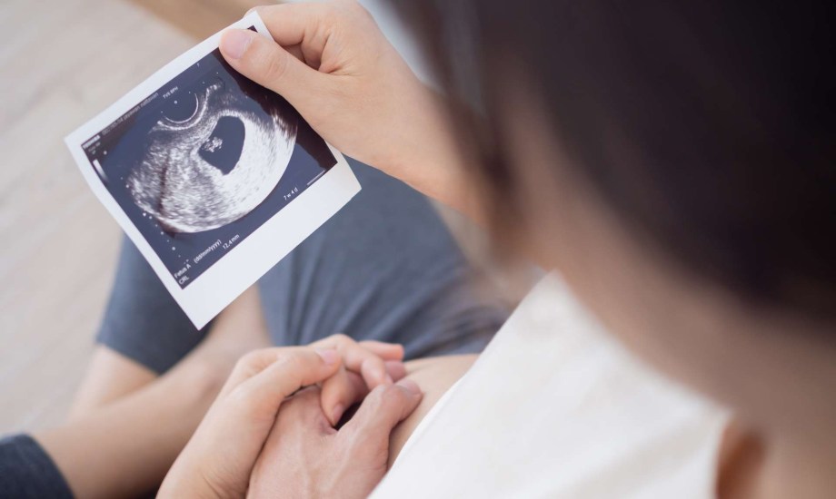 كيس الحمل الفارغ السبب الأول للإجهاض