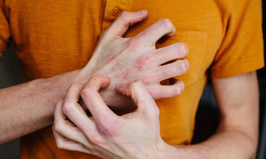 أسباب الطفح الجلدي الناتج عن التوتر وأعراضه وعلاجه