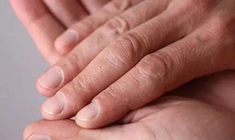 4 طرق سحرية للعناية بأظافر الرجال