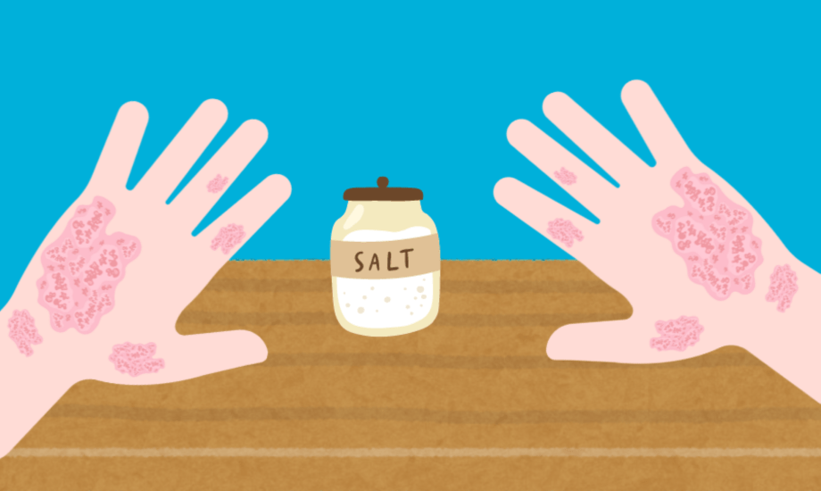 مكافحة التهاب الجلد الناتج عن الإفراط في تناول الملح