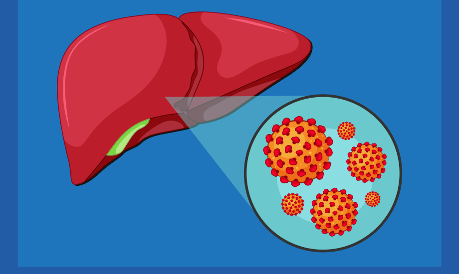تحديث لقاح التهاب الكبد B يثير جدلاً حول المواليد والمناعة للكبار