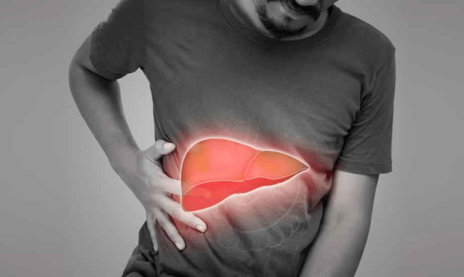 فشل الكبد.. الأسباب والأعراض والأنواع