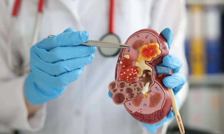 علاج مضاعفات مرض الكلى المزمن