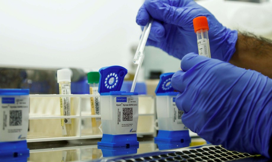 دراسة تكشف إمكانية انتقال كوفيد-19عبر السائل المنوي