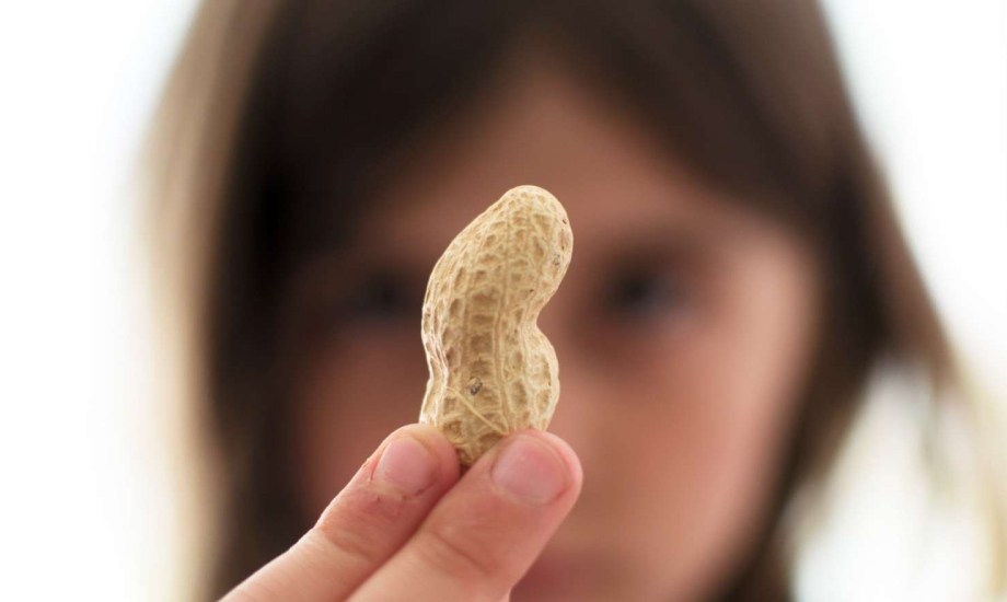 لاصقة تخفف حساسية الفول السوداني لدى الأطفال