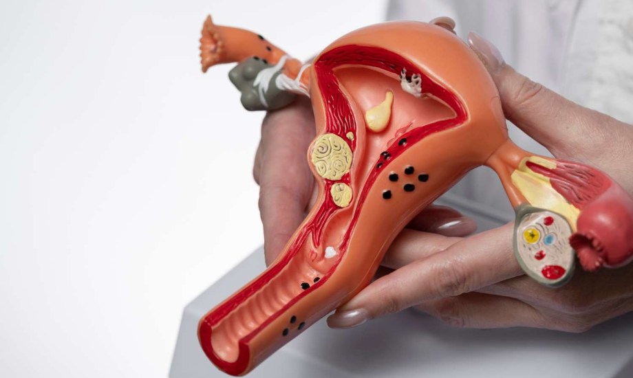 عوامل خطر سرطان بطانة الرحم