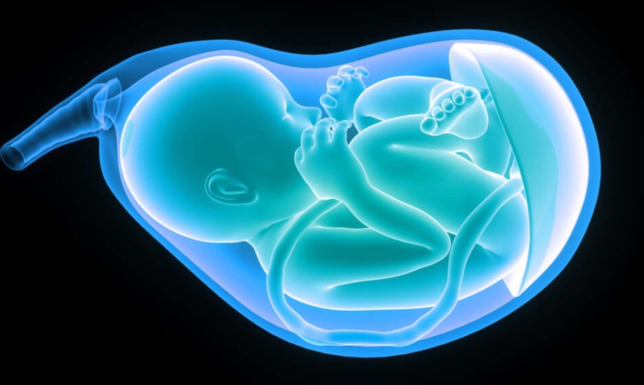 تشخيص التصاق الحبل السري الغشائي والوقاية منه