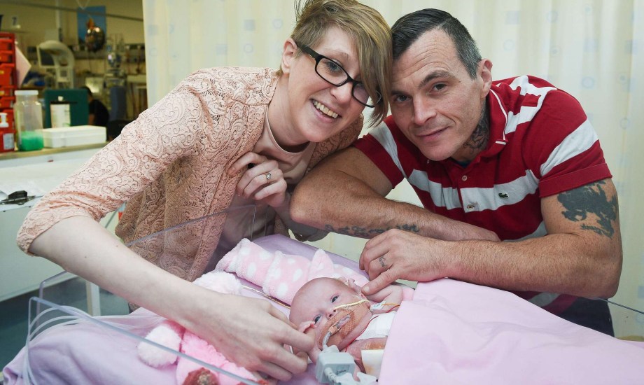 بعد ولادة طفلة بريطانية بقلب خارج جسدها