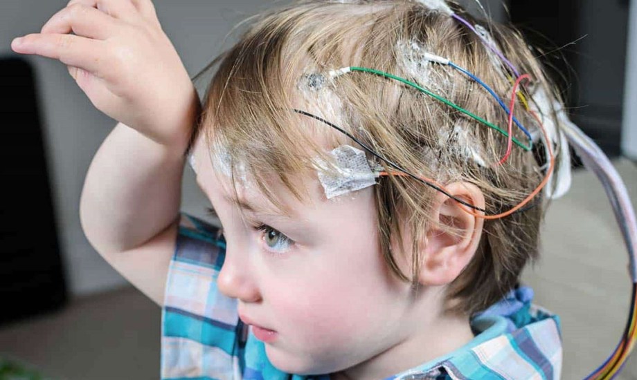 نوبات الصرع لدى الأطفال