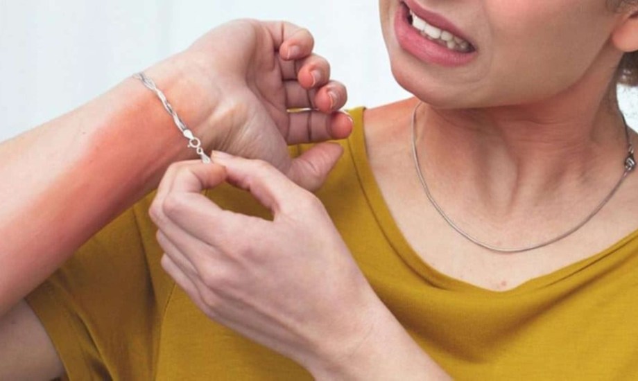 حساسية الذهب.. أعراضها والوقاية منها 