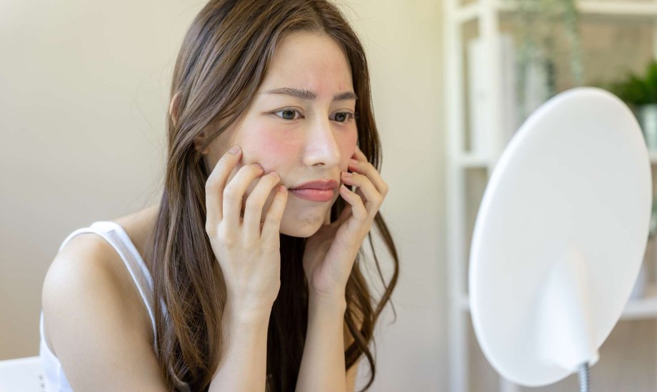 الطفح الجلدي على الوجه جرس إنذار لـ8 أمراض