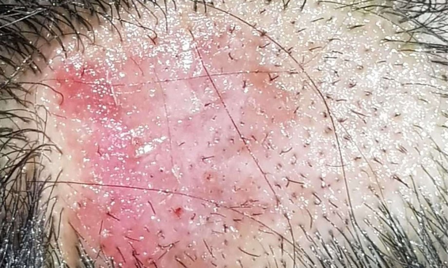 علامات في الرأس تشير إلى مرض خطير