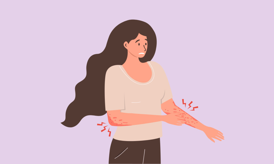 الإصابة بالفورميكيشن.. الأسباب والأعراض والعلاج