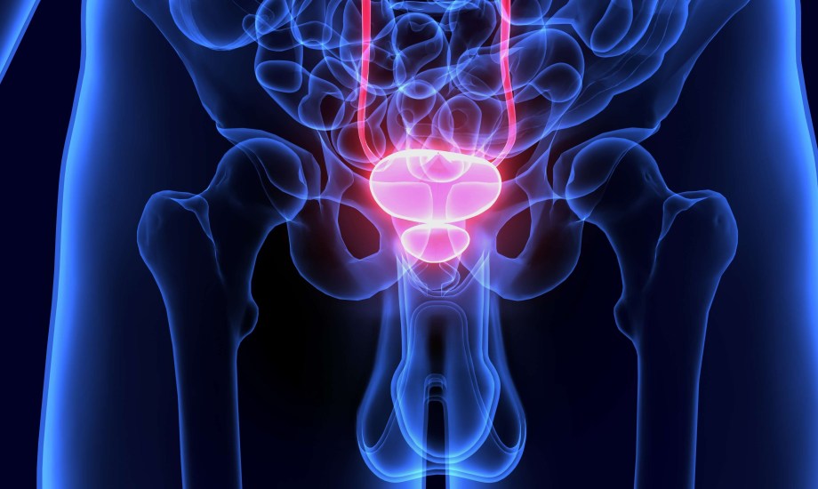 استخدام عقار Gozellix الجديد لتصوير سرطان البروستاتا