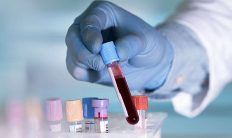 اختبار دم بسيط ينقذ حياتك.. كيف يتنبأ بأمراض القلب قبل سنوات؟
