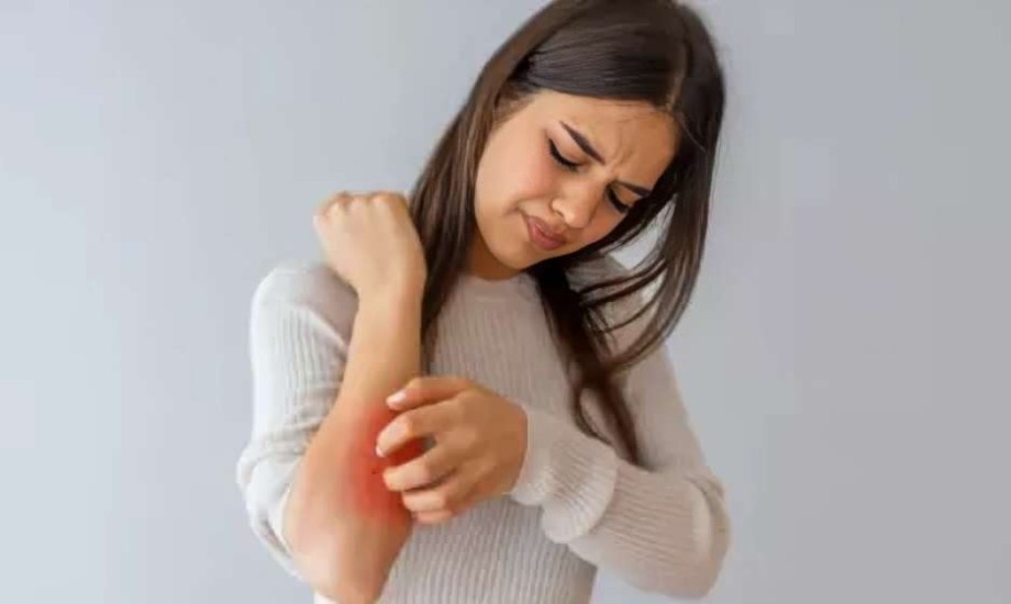 حساسية الفراش تهددك في الصيف