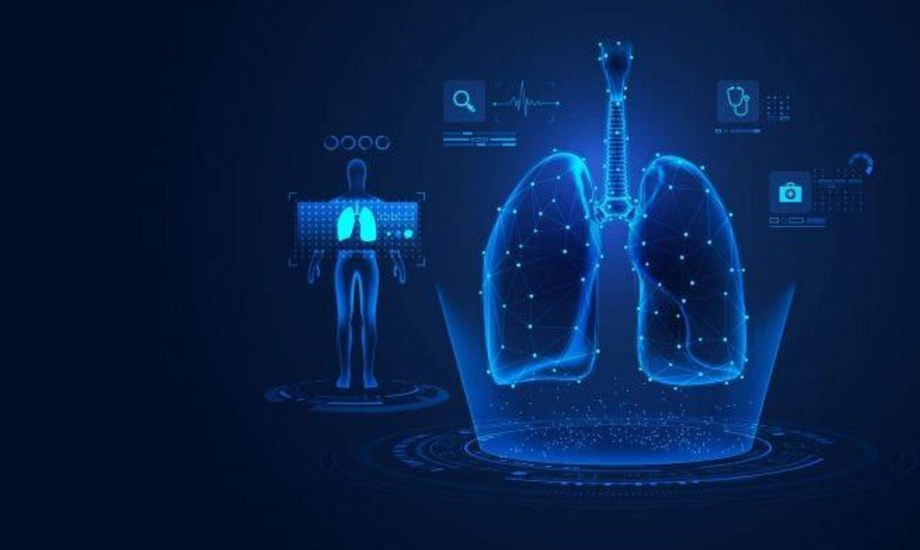 ذكاء اصطناعي يتنبأ بأورام الرئة لغير المدخنين