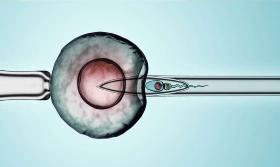 مميزات وعيوب الحقن المجهري داخل البويضة
