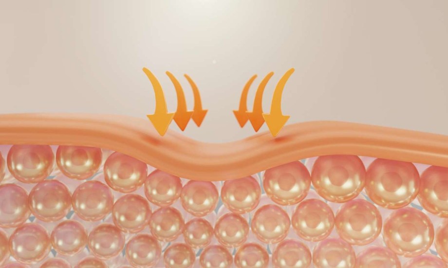 الأسباب الخفية لظهور الكتل تحت الجلد