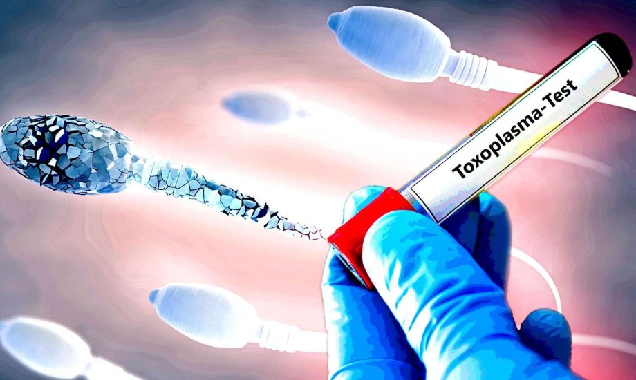 داء المقوسات يهدد خصوبة الرجال