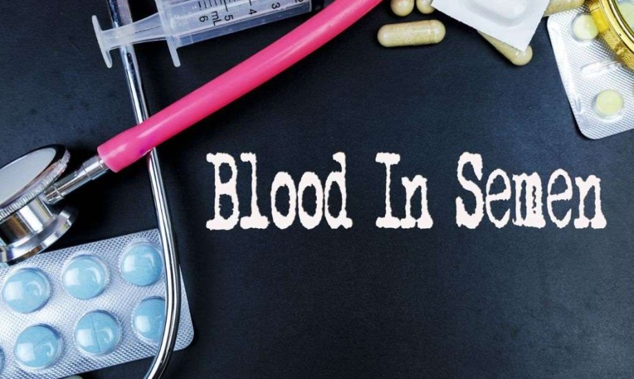 4 أسباب وراء ظهور الدم في السائل المنوي