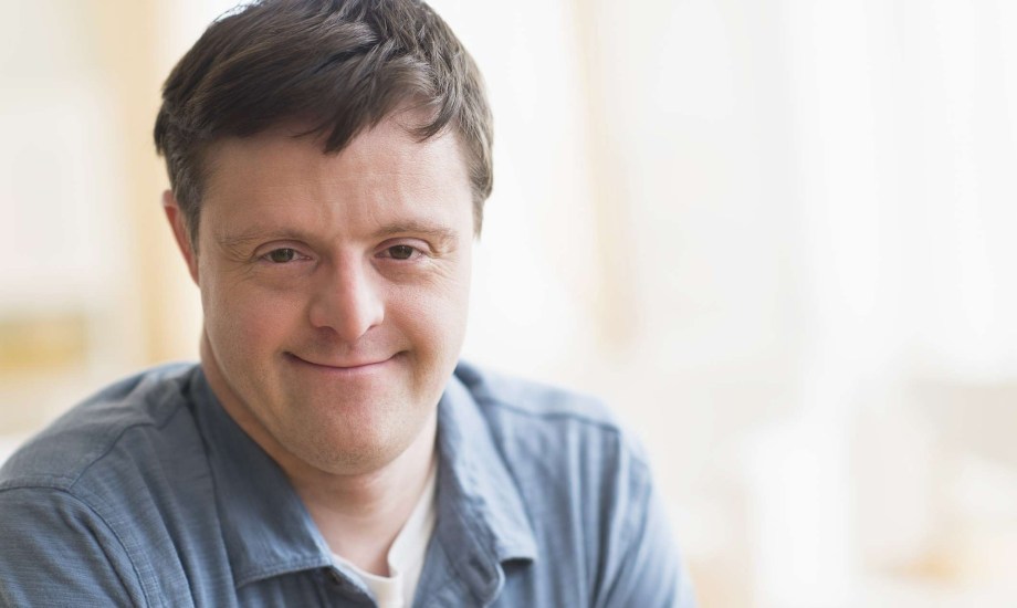 أسباب زيادة الإصابة بألزهايمر لدى المصابين بمتلازمة داون؟