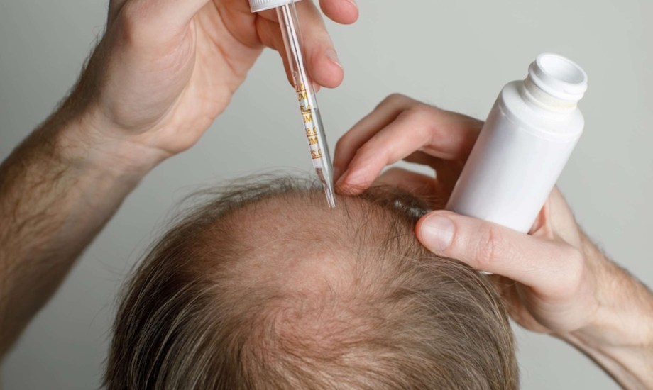 دواء ثوري قد يكون الحل النهائي للصلع