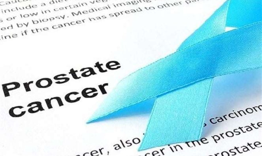 مزيج دوائي جديد لعلاج أورام البروستاتا المتقدمة