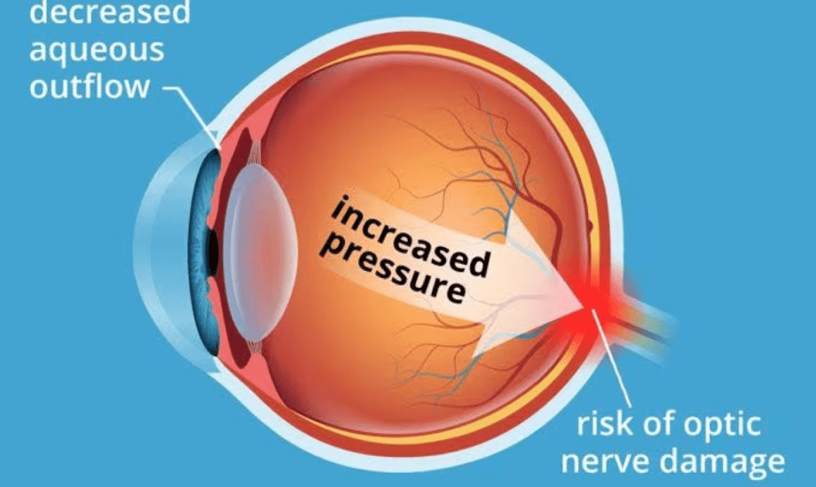 خطر فقدان البصر لدى مستخدمي Wegovy أعلى 5 مرات من Ozempic