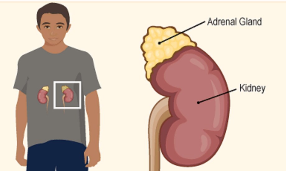 دواء جديد لعلاج قصور الغدة الكظرية عند الأطفال