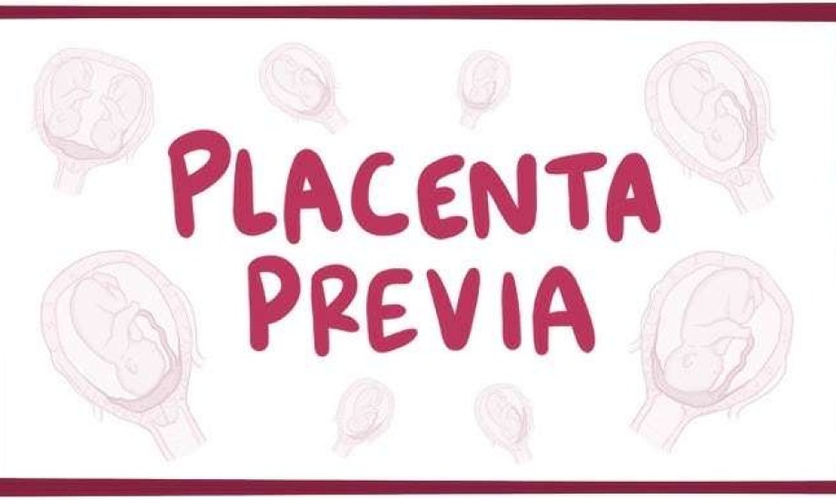 كيف تتعاملين مع تشخيص المشيمة المتقدمة؟