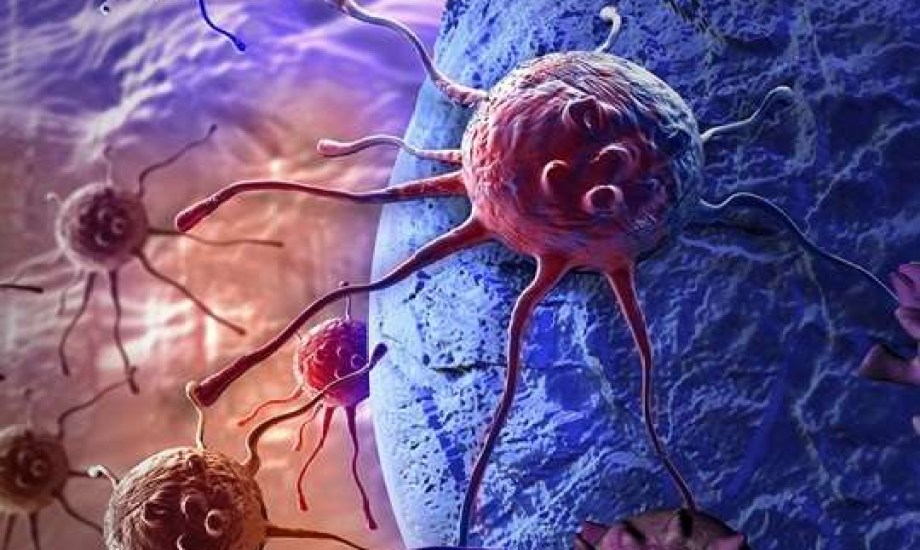 لا يوجد طعام سحري للأورام