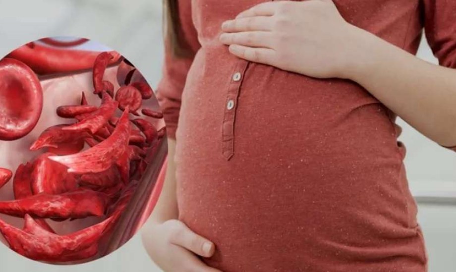 تأثير نقص الحديد أثناء الحمل عللى دماغ الأطفال