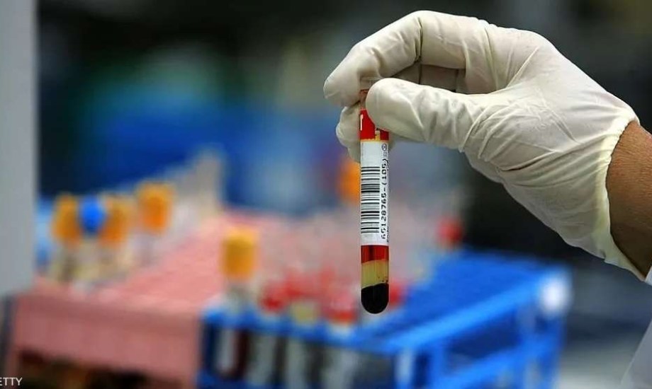 اختبار دم بسيط يخبرك كم عاماً ستعيش؟