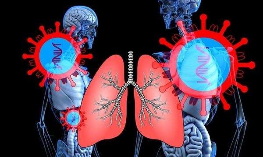 فيروس المخلوي التنفسي