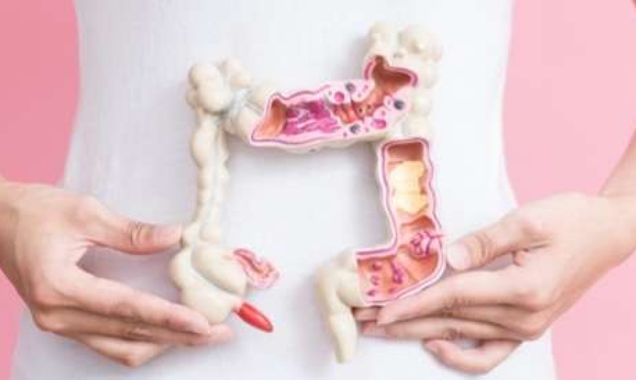 الأشعة المقطعية للكشف المبكر عن أورام القولون