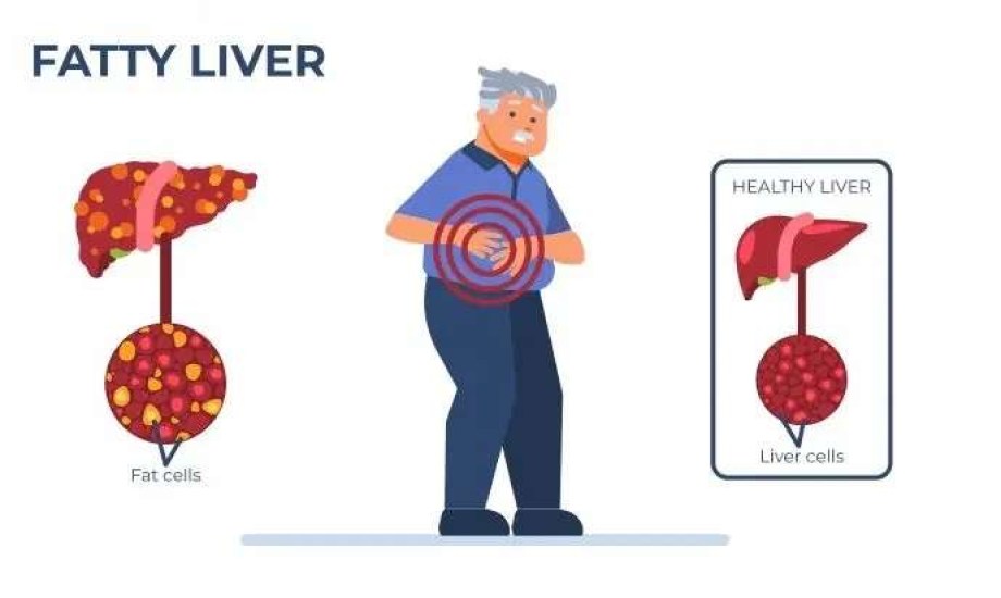 كيف يهدد الكبد الدهني السمع لدى كبار السن؟