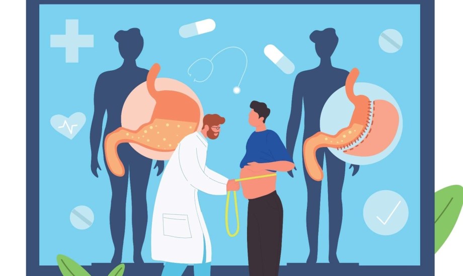 كيف تساهم جراحة إنقاص الوزن في إنقاذ الكبد من التلف؟