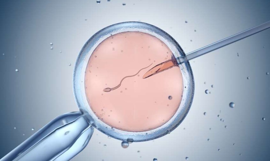 هل التلقيح الصناعي مؤلم؟